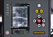 World premiere 2012 new ultrasound scanner with rectal linear probe – iScan